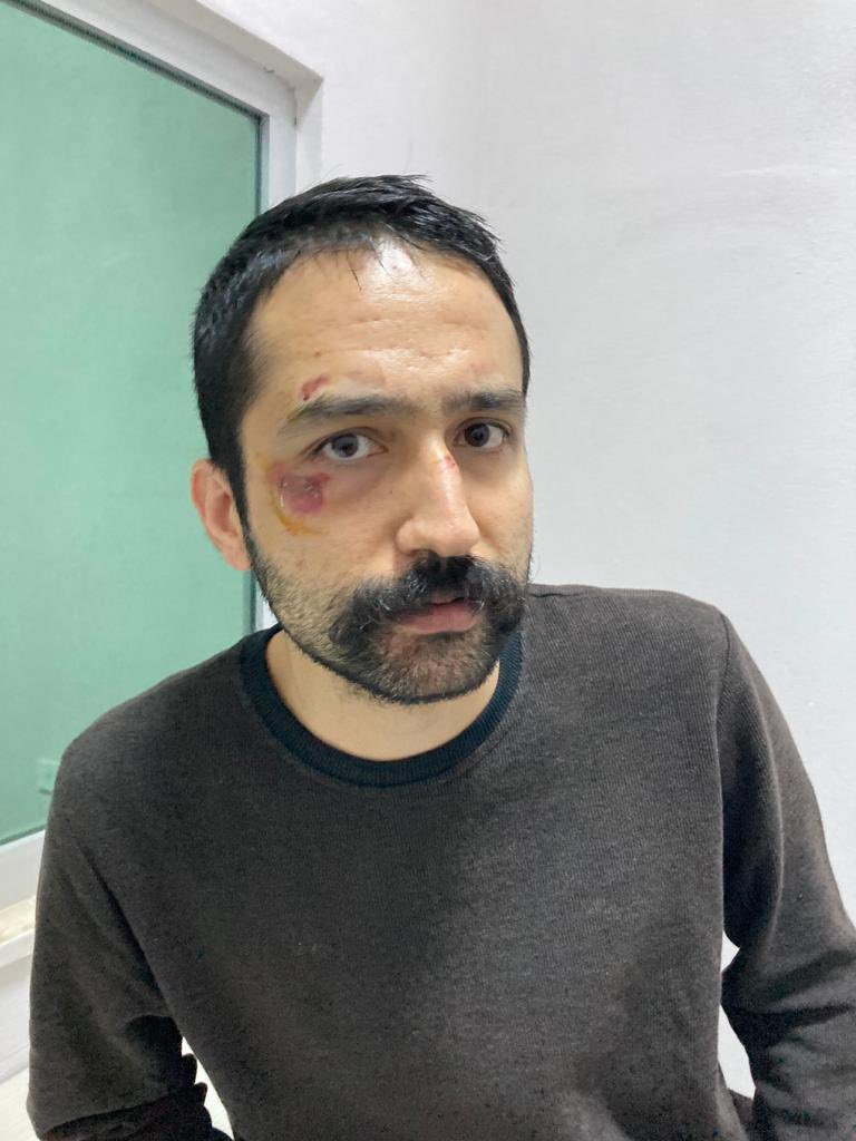 Hakkında hapishanede kalamaz raporu bulunan avukat Aytaç Ünsal tutuklandı